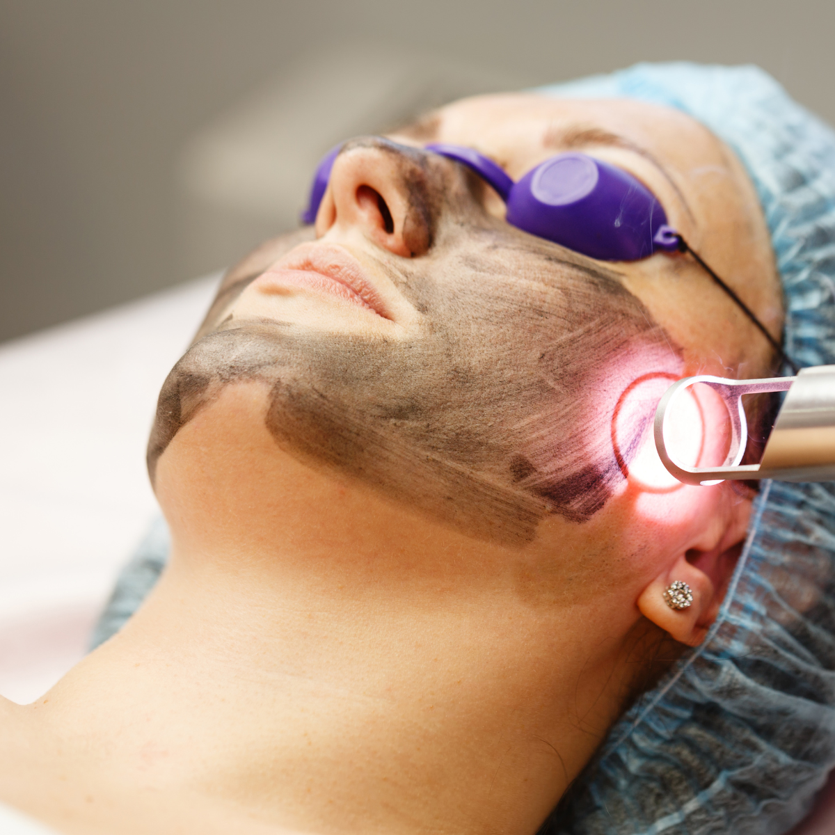 Laser Treatment