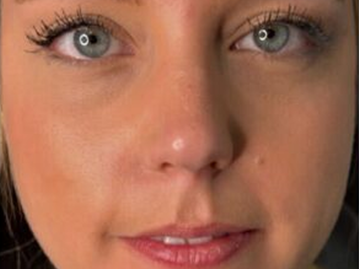 Precision medical aesthetic facial