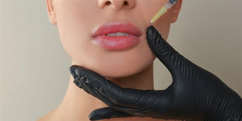 Professional natural lip filler treatment