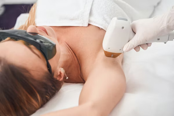 Laser Hair Removal Treatment