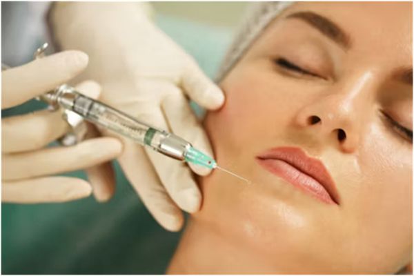 dermal filler treatment
