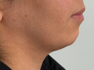 resized3_376x282 (1)