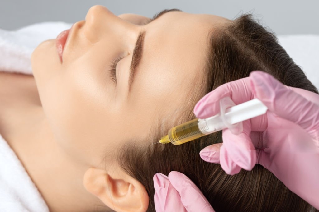 PRP Treatment for Hair Loss