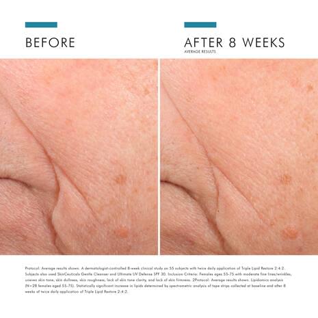 Improving skin results